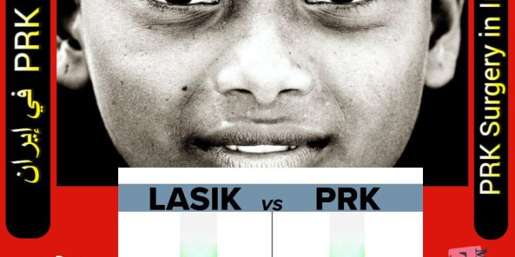 جراحة PRK في إيران