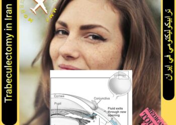 Trabeculectomy in Iran