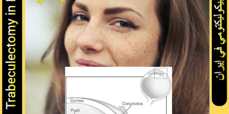 ترابيكوليكتومي في إيران: تعاريف وأنواع