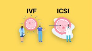 Intracytoplasmic sperm injection