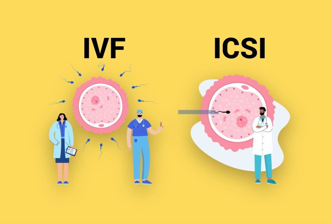 انٹراسیٹوپلاسمک سپرم انجیکشن (ICSI): تعریف اور اقسام