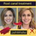 علاج قناة الجذر في إيران