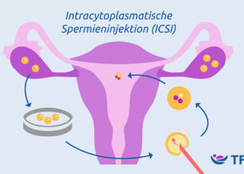 حزمة علاج التبرع بالبويضات والحقن المجهري