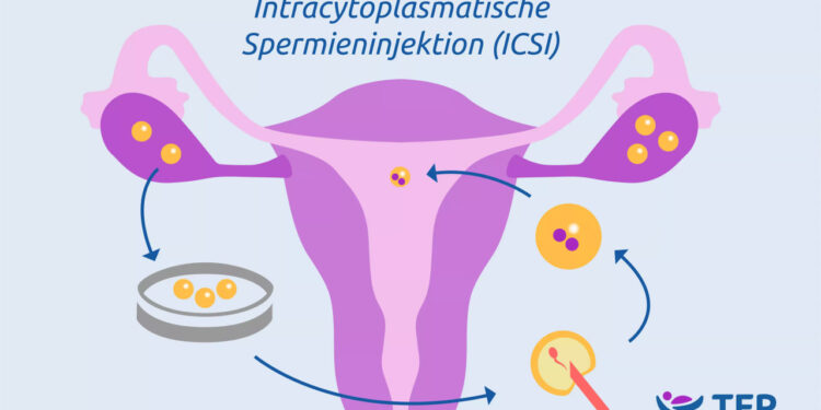 حزمة علاج التبرع بالبويضات والحقن المجهري