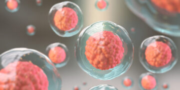 伊朗干细胞不孕症治疗方案