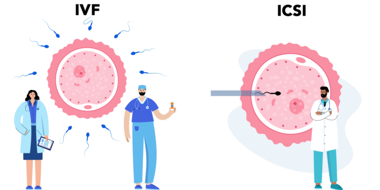 عرض مميز لعلاج ICSI في إيران
