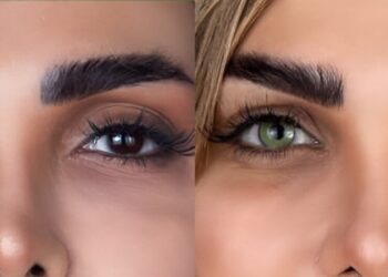 Special offer for permanent eye color change using Keratopigmentation technique in Iran