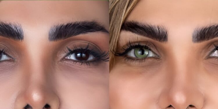 Special offer for permanent eye color change using Keratopigmentation technique in Iran