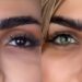 Special offer for permanent eye color change using Keratopigmentation technique in Iran